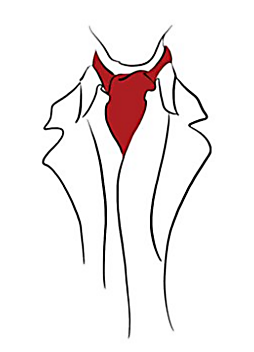 ASCOT CONSULTING